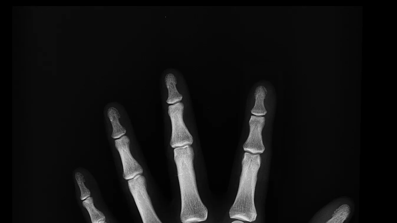 Az orvosokat is sokkolta, amikor meglátták a férfi kezét