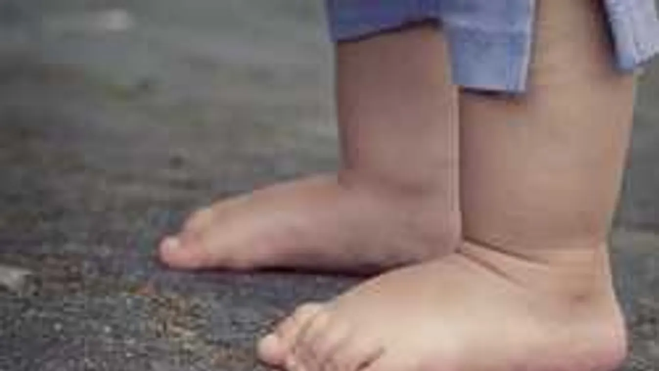 A halottkém is elborzadt, mikor meglátta a csecsemőt