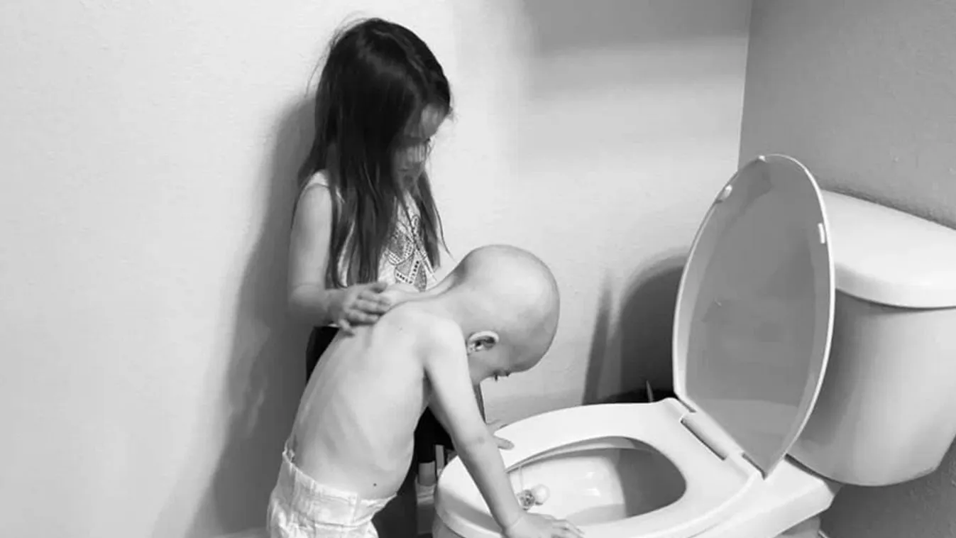 Szívszaggató fotók: Így gondozza leukémiás öccsét az 5 éves kislány