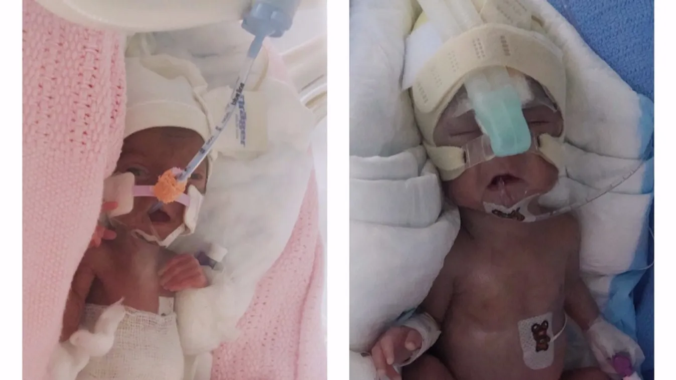 Foglyul ejtett egy újszülöttet a kórház, 37 milliót kérnek érte!