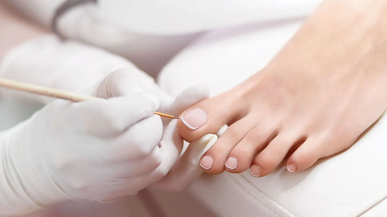 Nagyon durva mi történt a nő lábával egy elszúrt pedikűr után