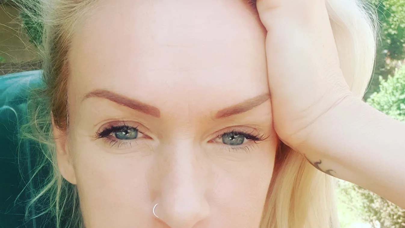 Ijesztő fotó: Mi történt Molnár Anikó lábfejével?