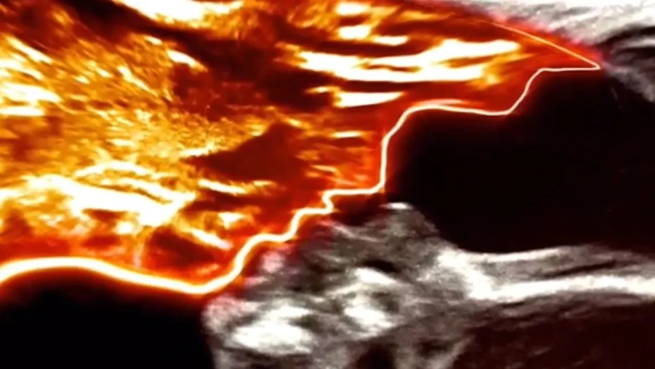 Sokkot kapott a kismama, amikor meglátta ezt a terhességi ultrahangot