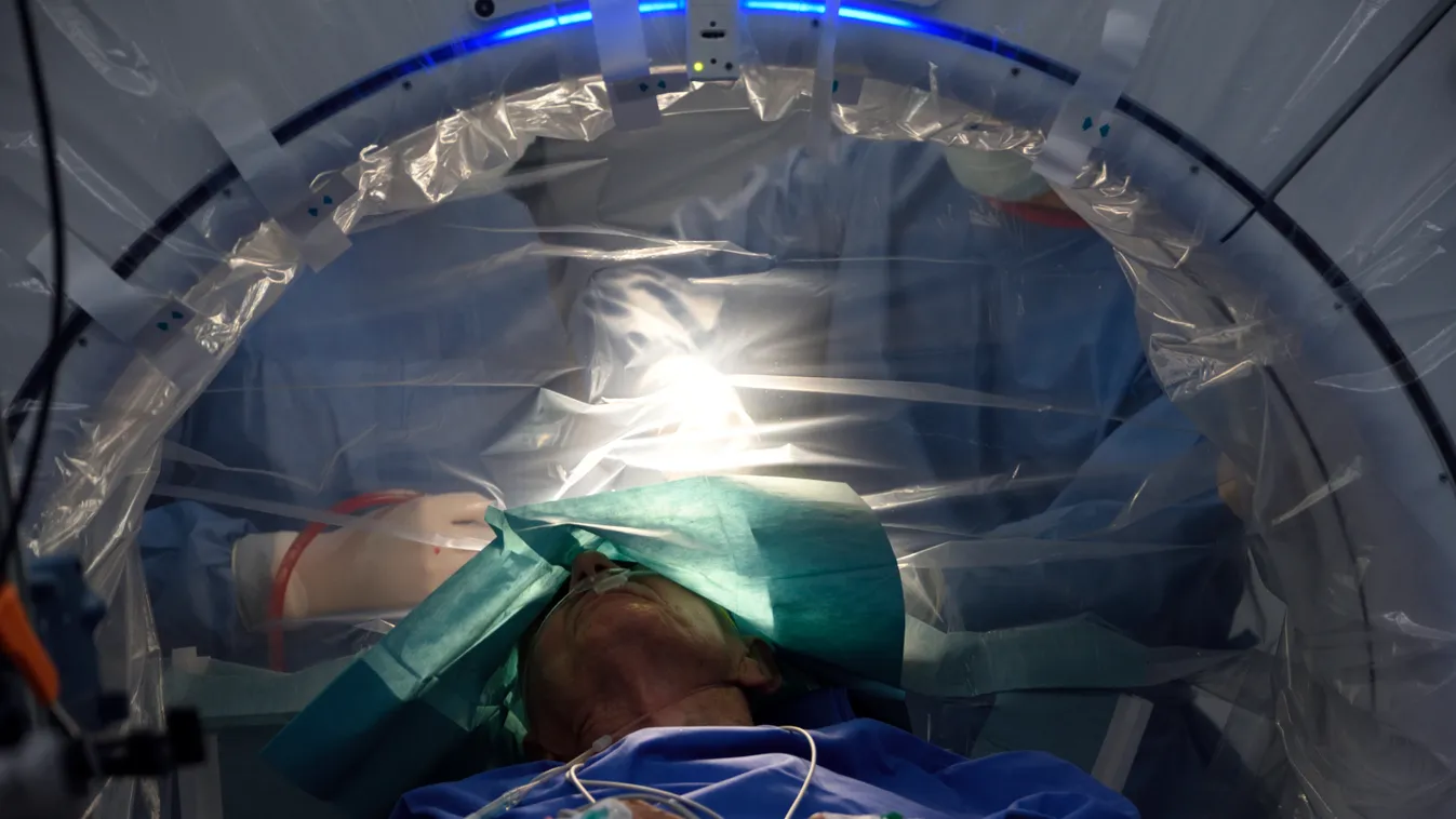 Elképesztő, ezt ültették a beteg agyába Szegeden