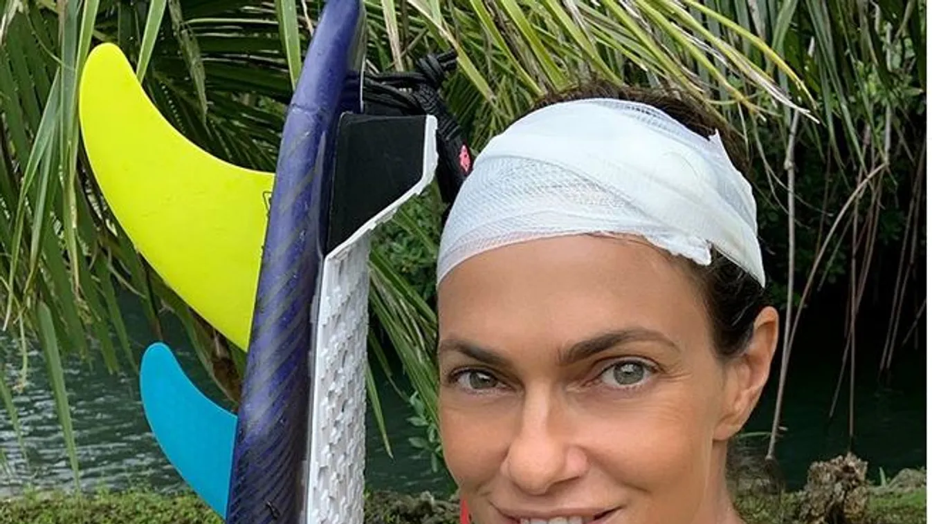 Így gyógyítja magát súlyos sérülése után a magyar modell