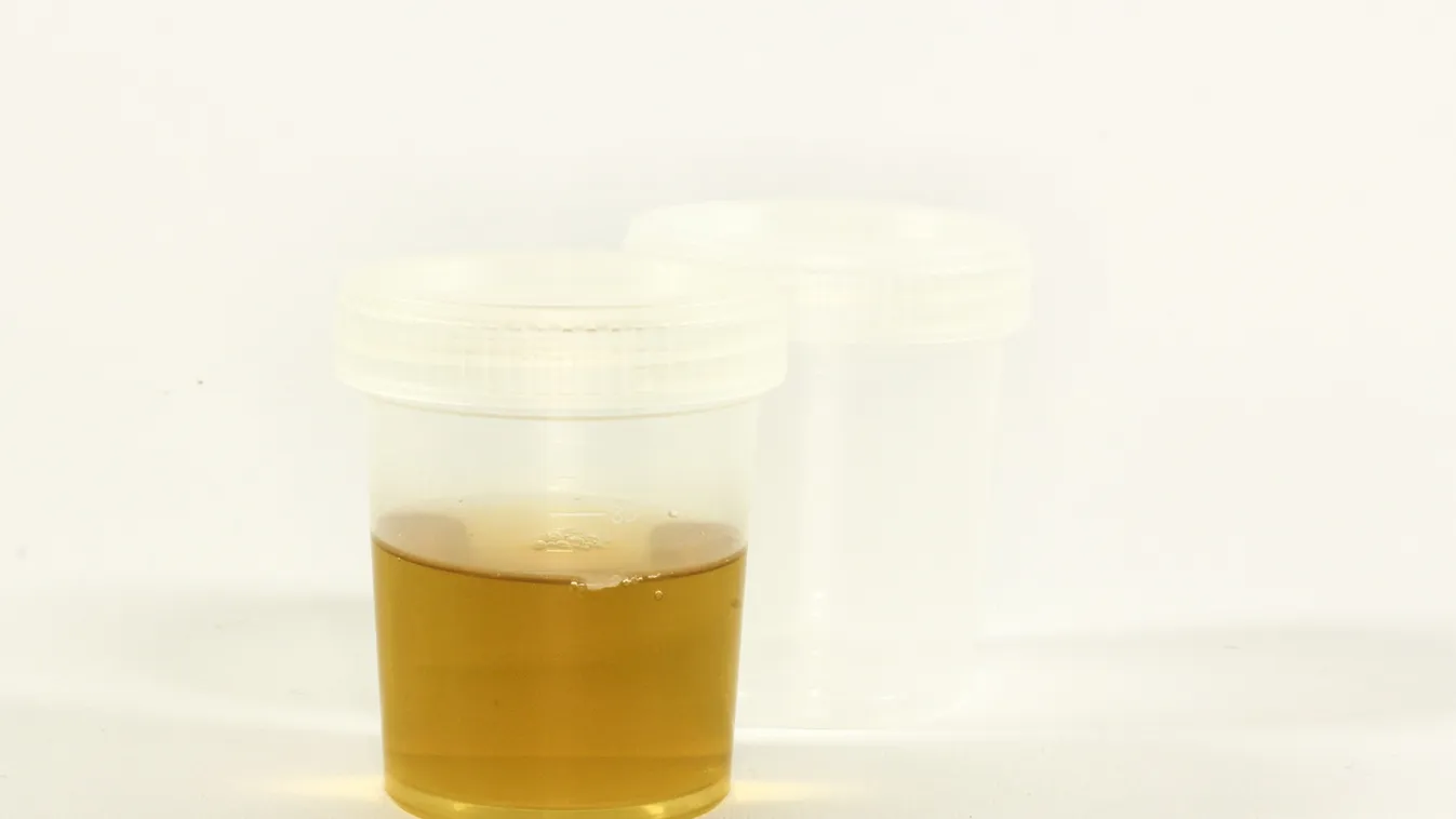 Ilyen nincs: valódi alkoholt pisil egy amerikai nő