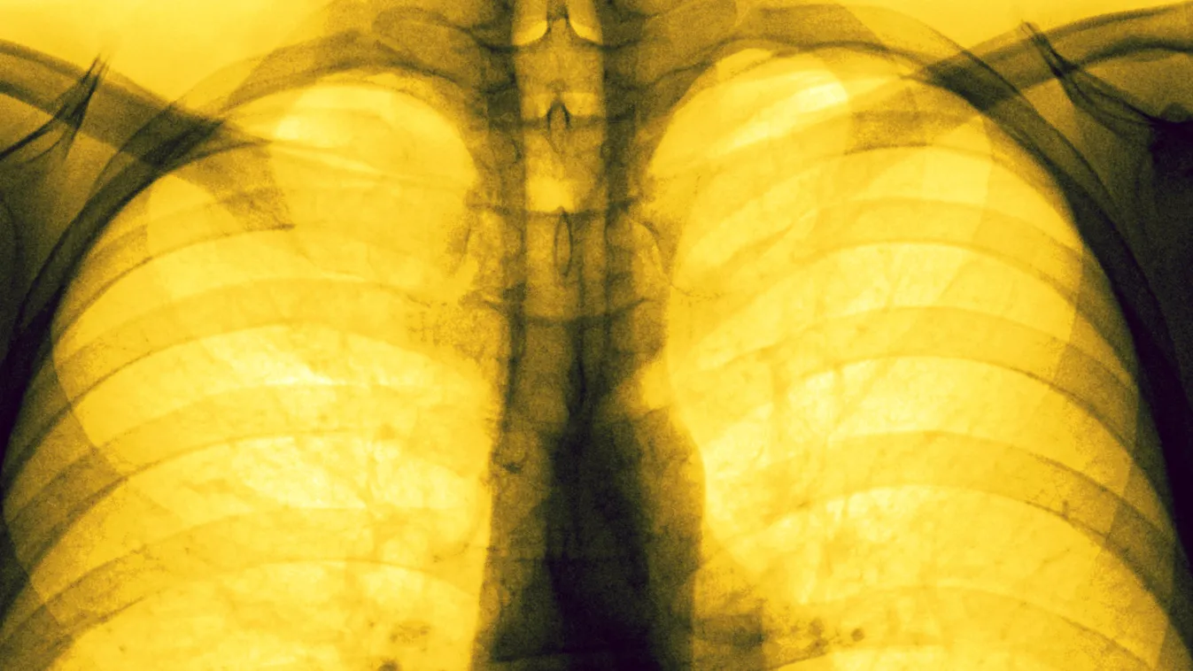 Kiszűri a koronavírust a magyar fiatalok találmánya