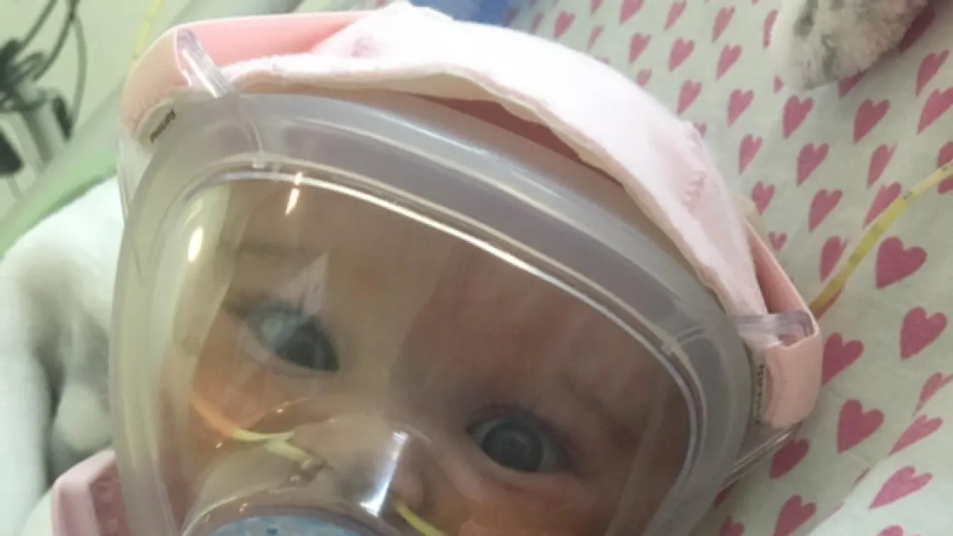 Ismét az életéért harcol a koronavírusos csecsemő