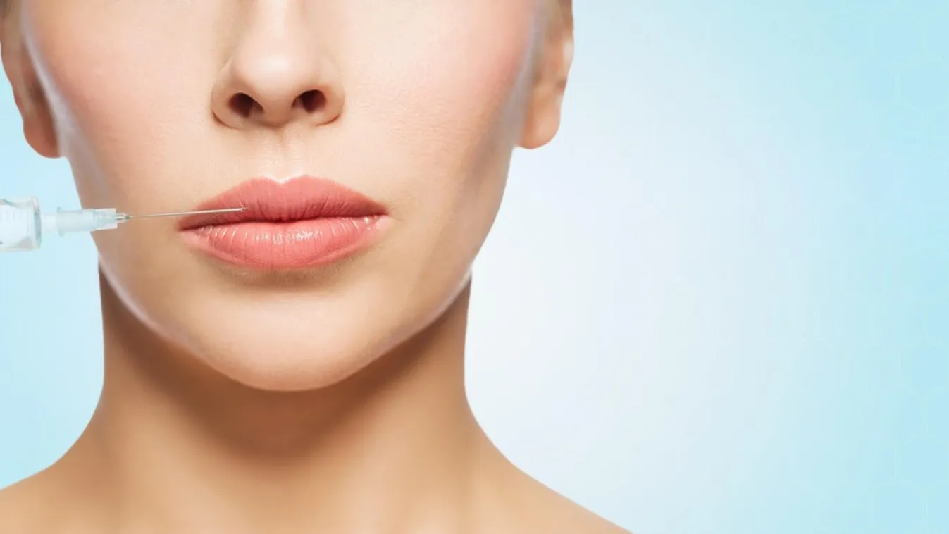 Horror: Gigantikus plasztikát visel magán a nő, és még nem áll le