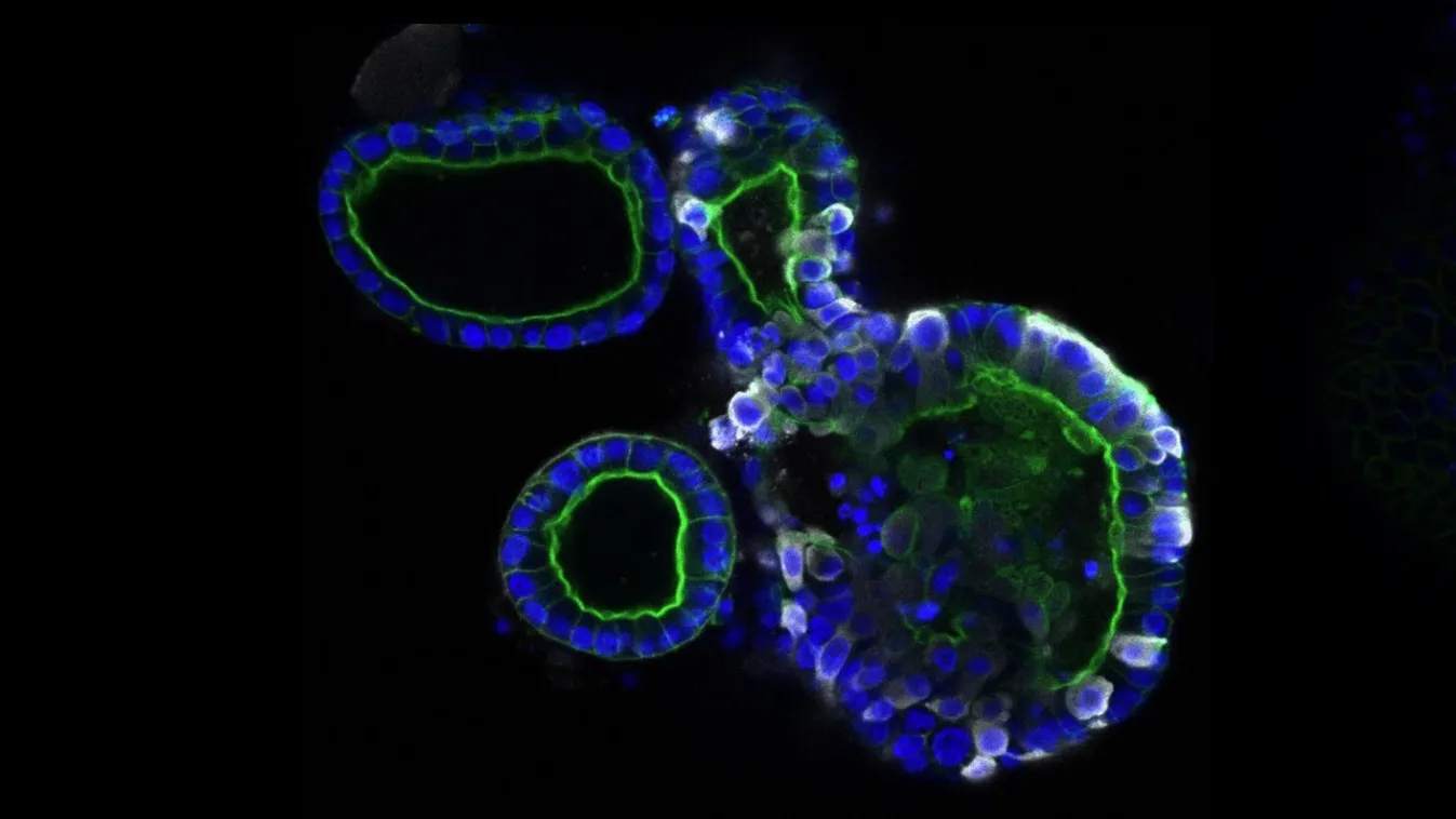 Hátborzongató mikroszkópos fotók, így támadja az emberi sejteket a koronavírus!