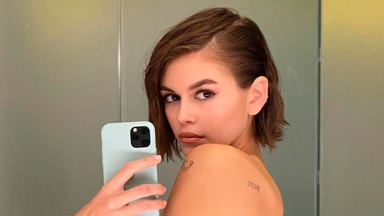 Durva röntgenfelvétel: Csúnyán megsérült Cindy Crawford lánya - Fotó