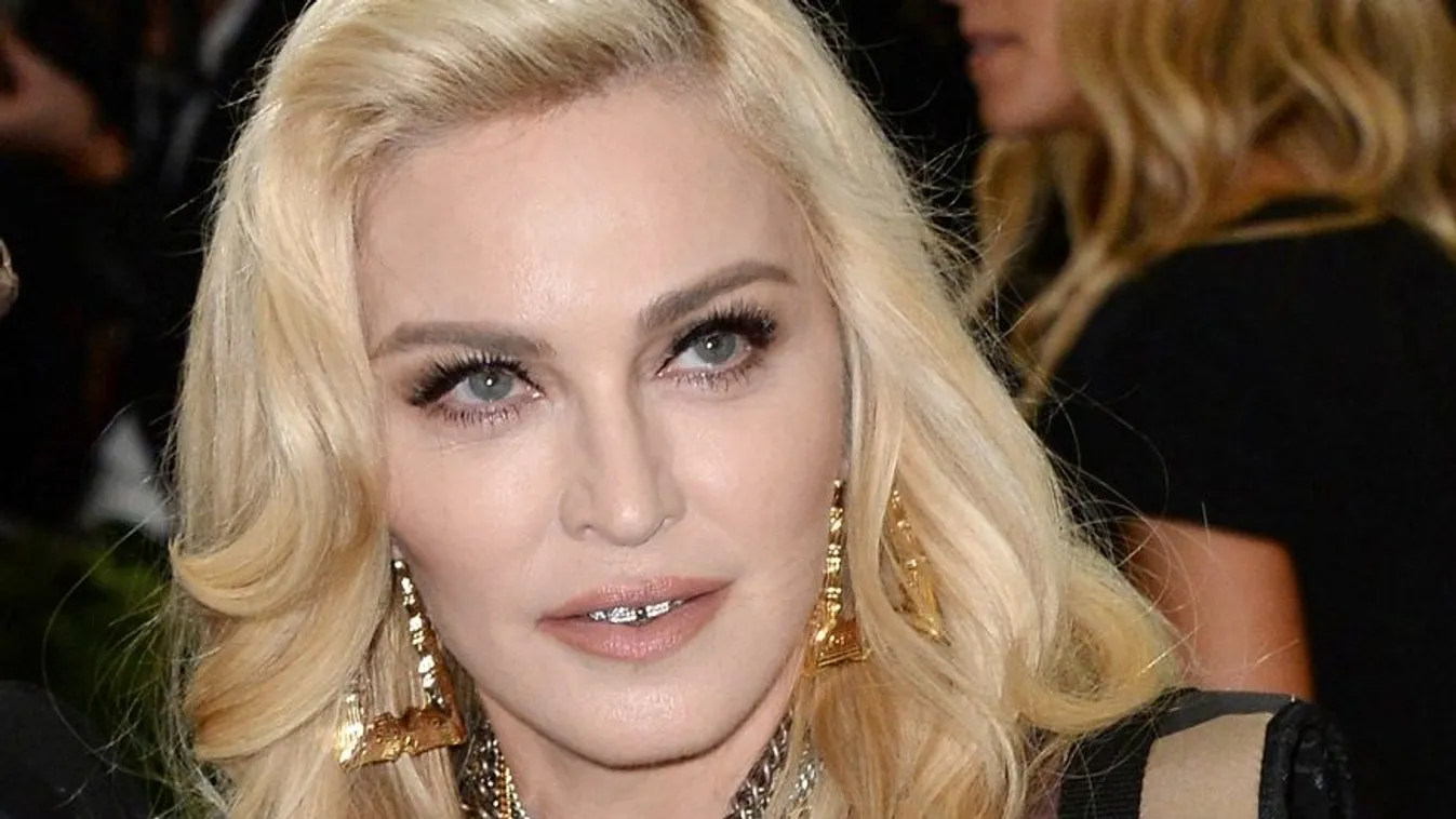 Fenékmutogatással jelentette be Madonna, hogy meg kell műteni - Fotó