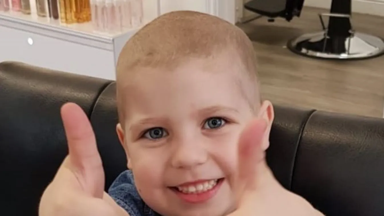 Megszakad a szív: 800 kemoterápiát kapott a kislány, a gyerekek folyamatosan csúfolják