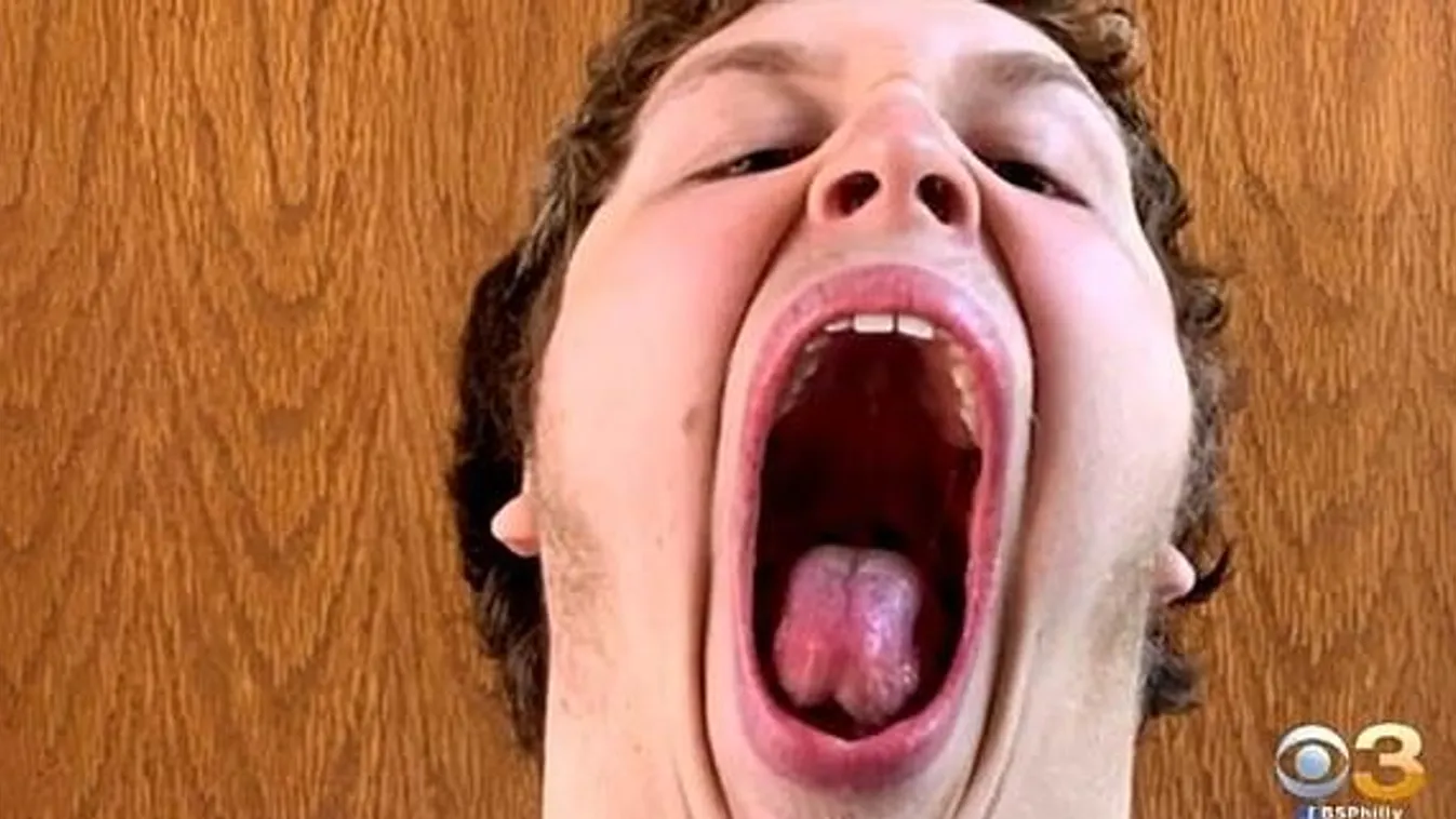 Riasztó látvány: Elképesztő, mire képes a szájával ez a 16 éves tini - Fotó