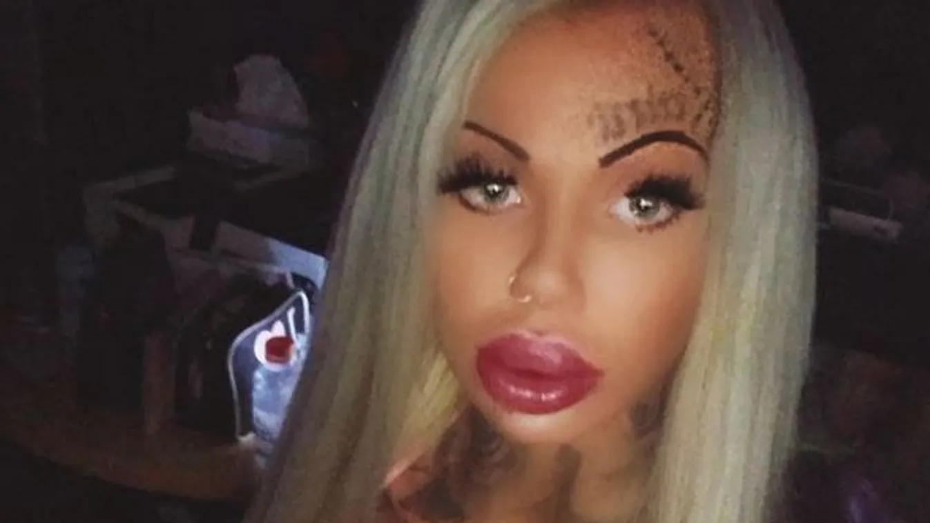 Szexbabává műttette magát a 27 éves nő: brutális plasztikán esett át