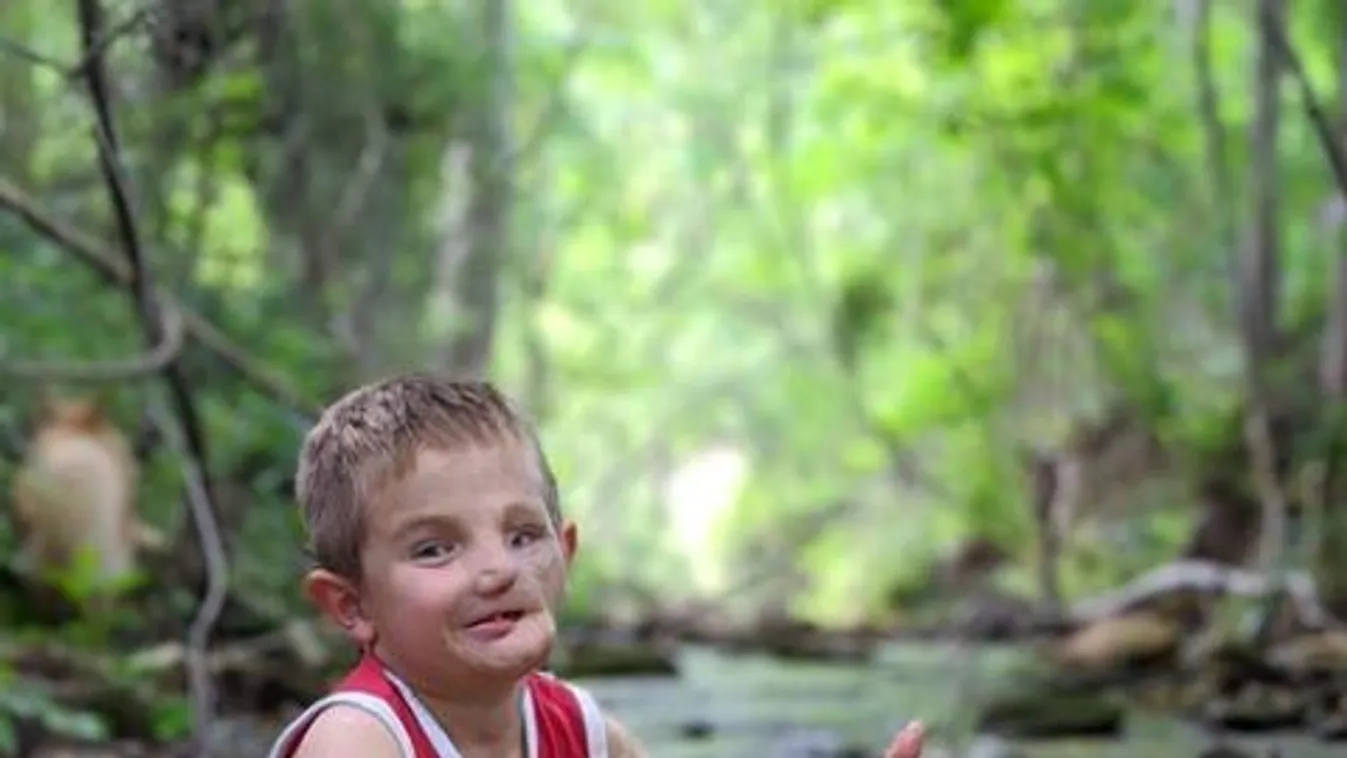 Szóltak a szülőknek, készüljenek a legrosszabbra: 45 műtéten esett át az 5 éves kisfiú