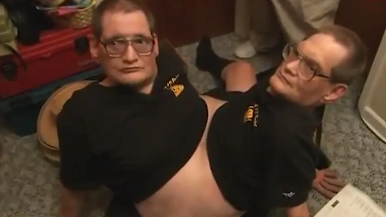 Szívszorító: elhunyt a világ legidősebb összenőtt ikerpárja -videó