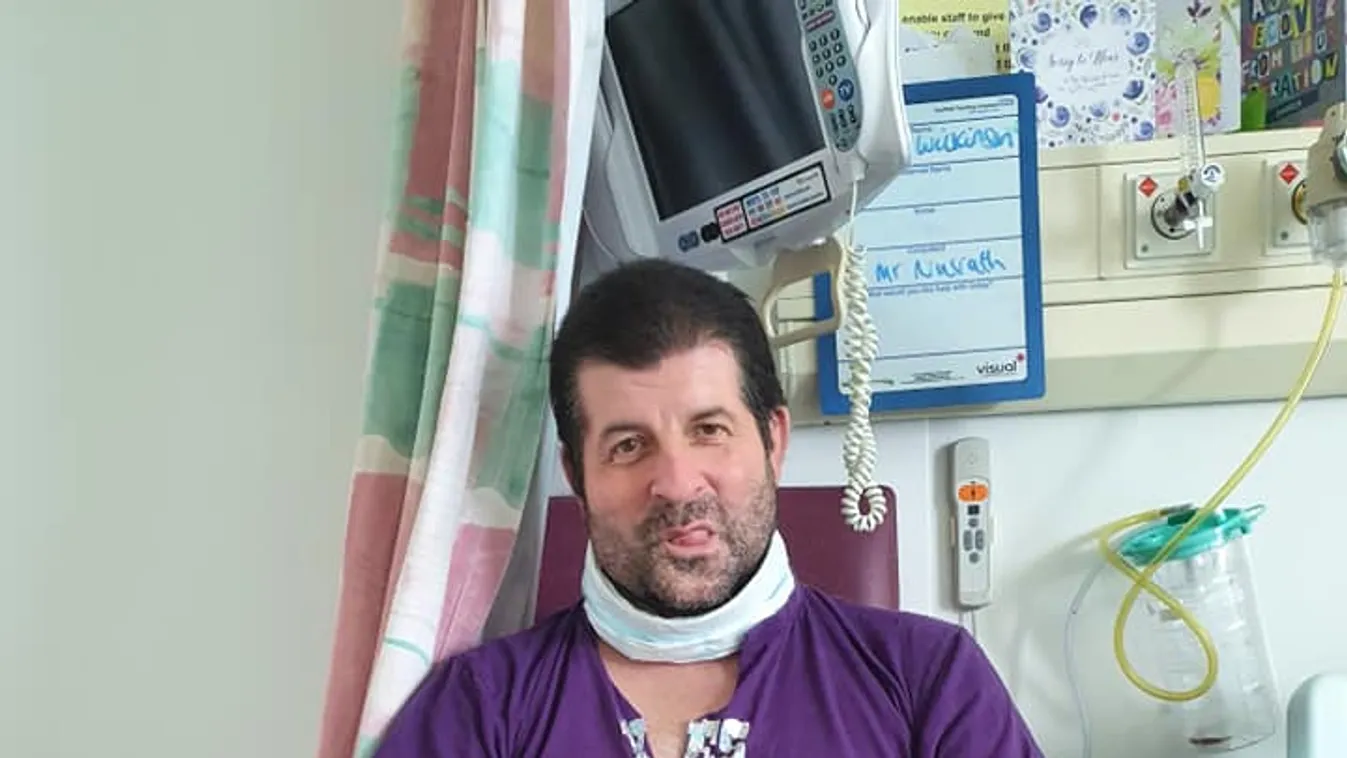 Sokkot kapott a fogorvos, amikor meglátta, mi van a férfi röntgenképén