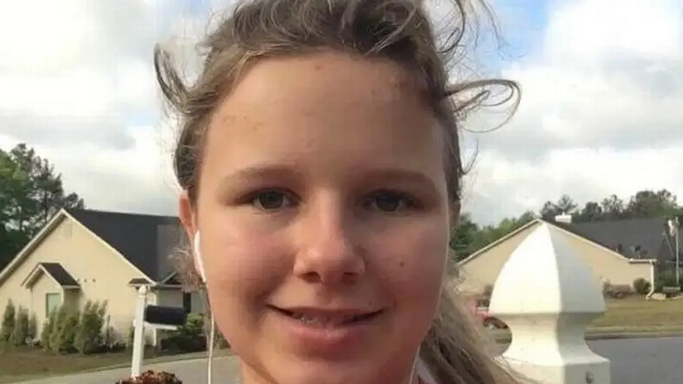 Élet és halál között lebeg: pitbullok marcangolták a 15 éves lányt –fotó