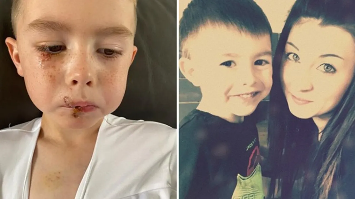 A család barátjának házában támadt rá a megvadult kutya a 4 éves kisfiúra – fotó