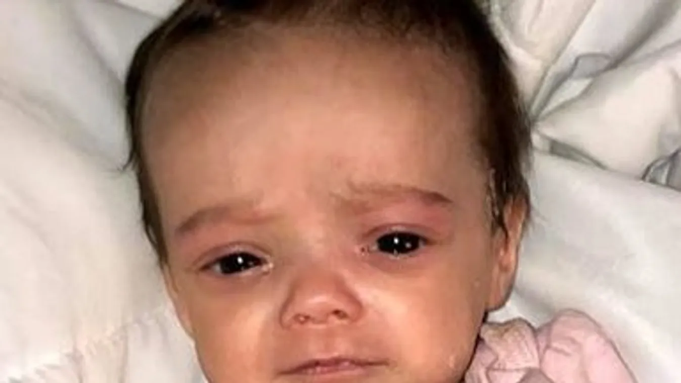 Véres pelenkában fotózta pár hónapos kislányát az apa: borzalom, mit kellett kiállnia a kicsinek