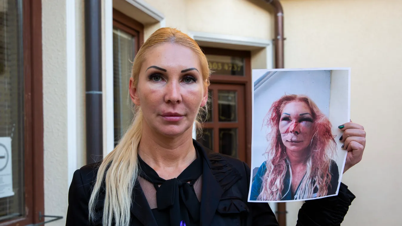 Kiderült: ezért maradt el a megvert Orosz Bernadett tárgyalása