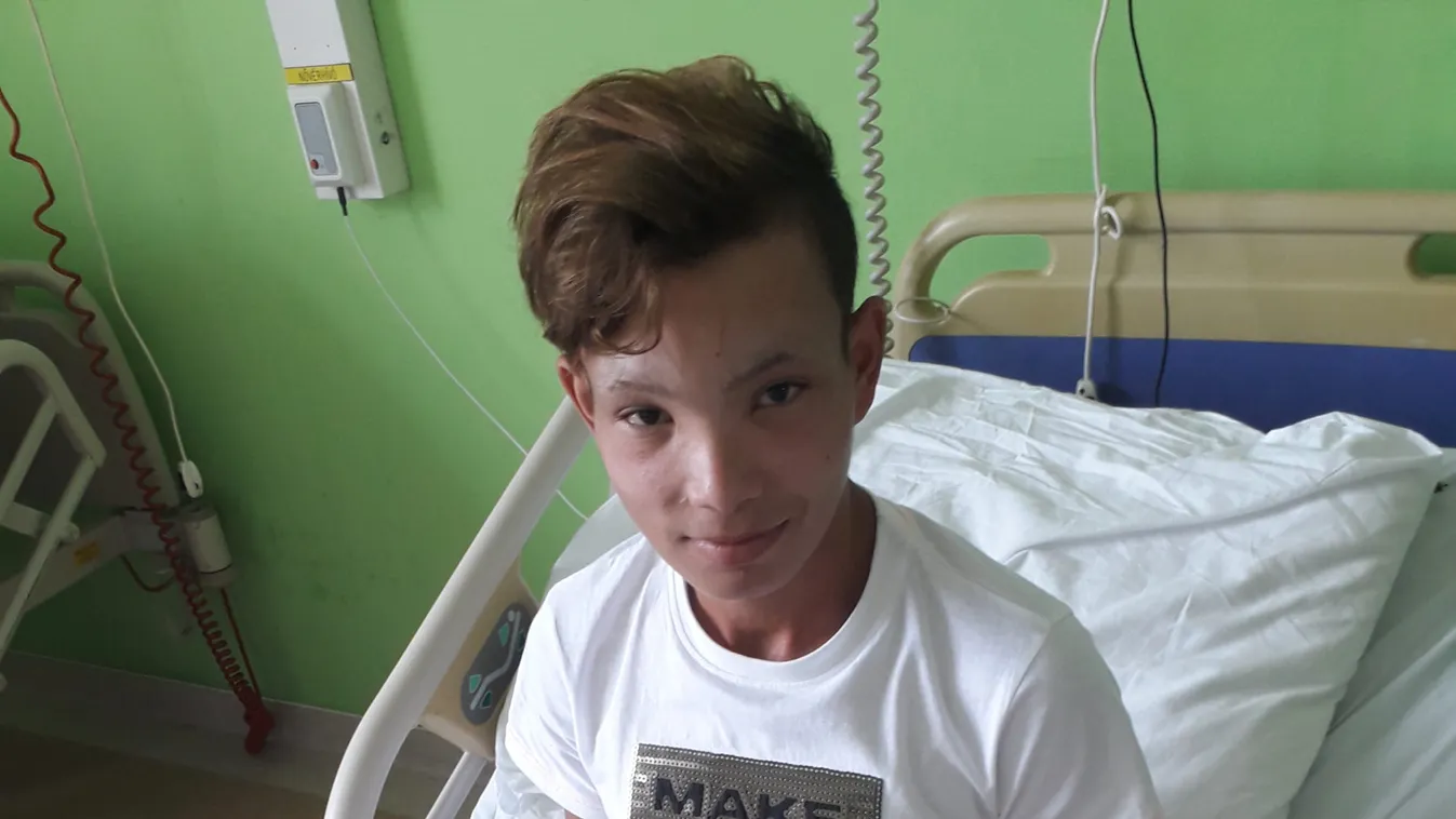 Megkezdték a kezelését az elefántlábú fiúnak