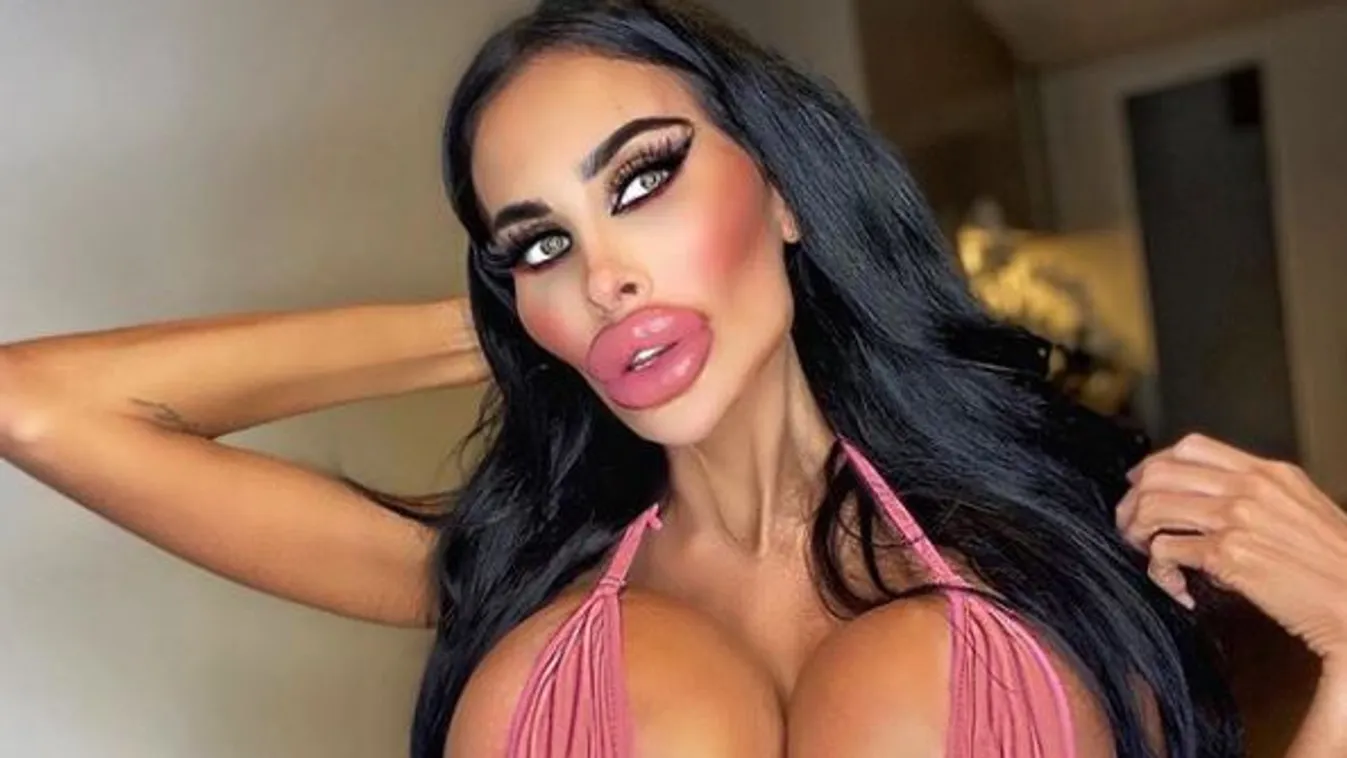 Új mellekkel terelte el a figyelmet az ápolónő a plasztikázott fejéről +18-as fotók