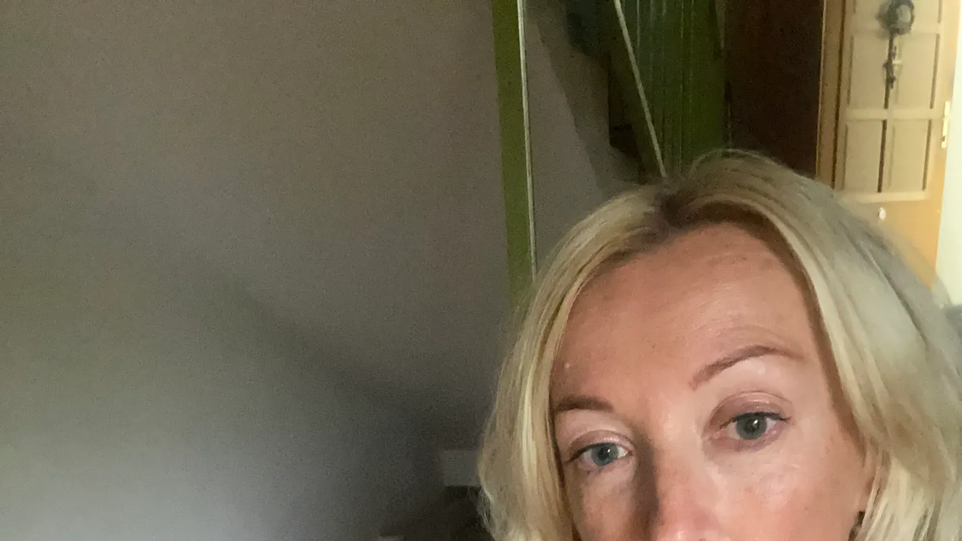 Durva balesetet szenvedett otthonában Kandász Andi