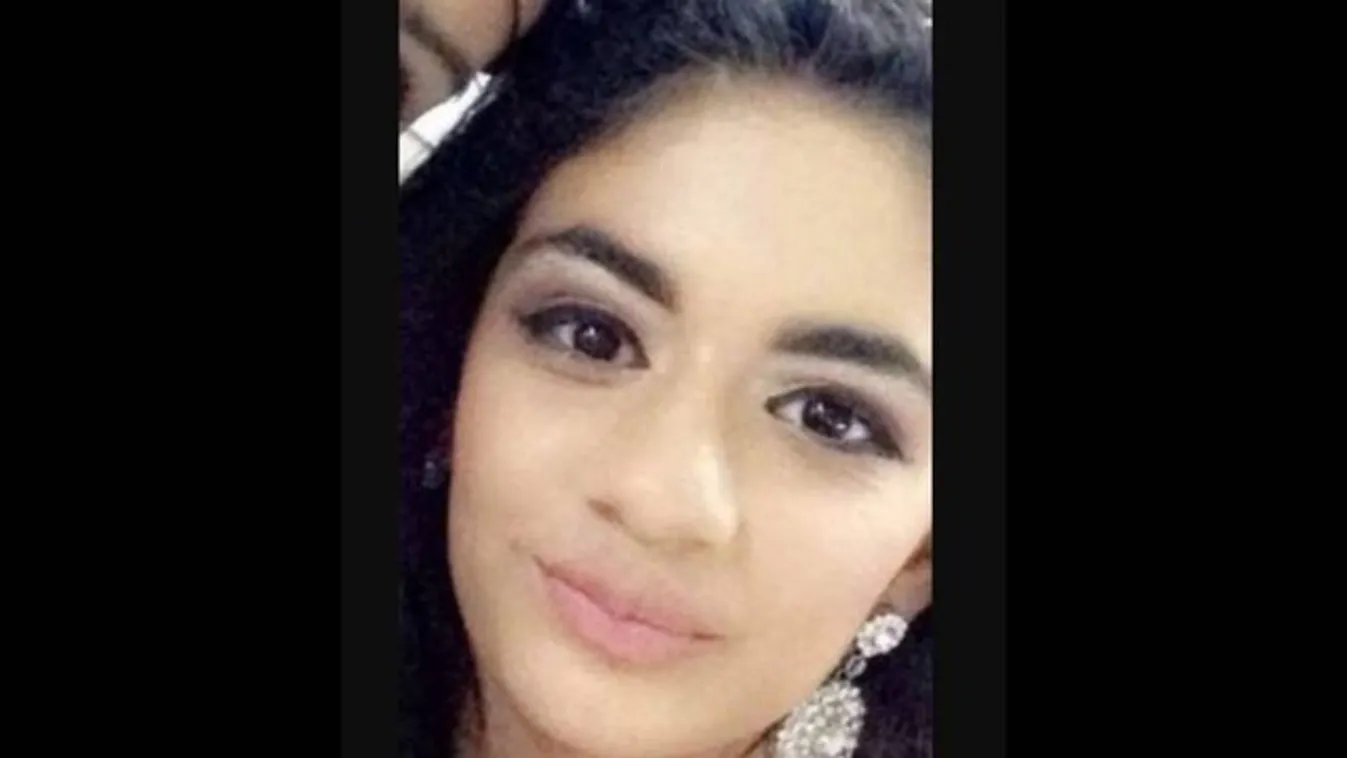 Mellbevágó: felismerhetetlenné égett egy kislány arca a tetűirtó sampon miatt