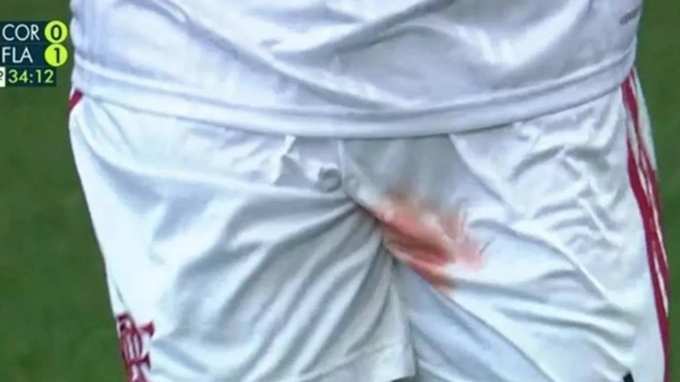 Véresre taposták a sztárfocista himbilimbijét