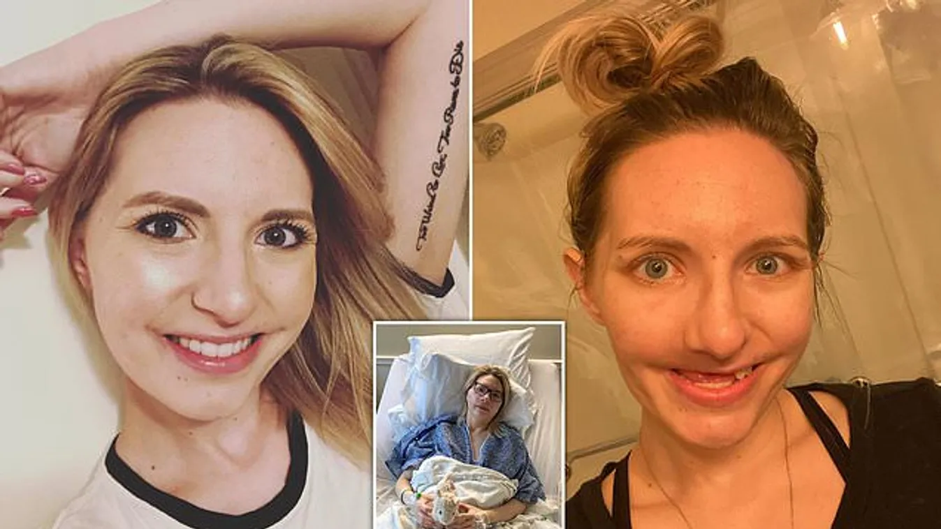 Fogfájással kezdődött, majd az életéért küzdött a 28 éves nő