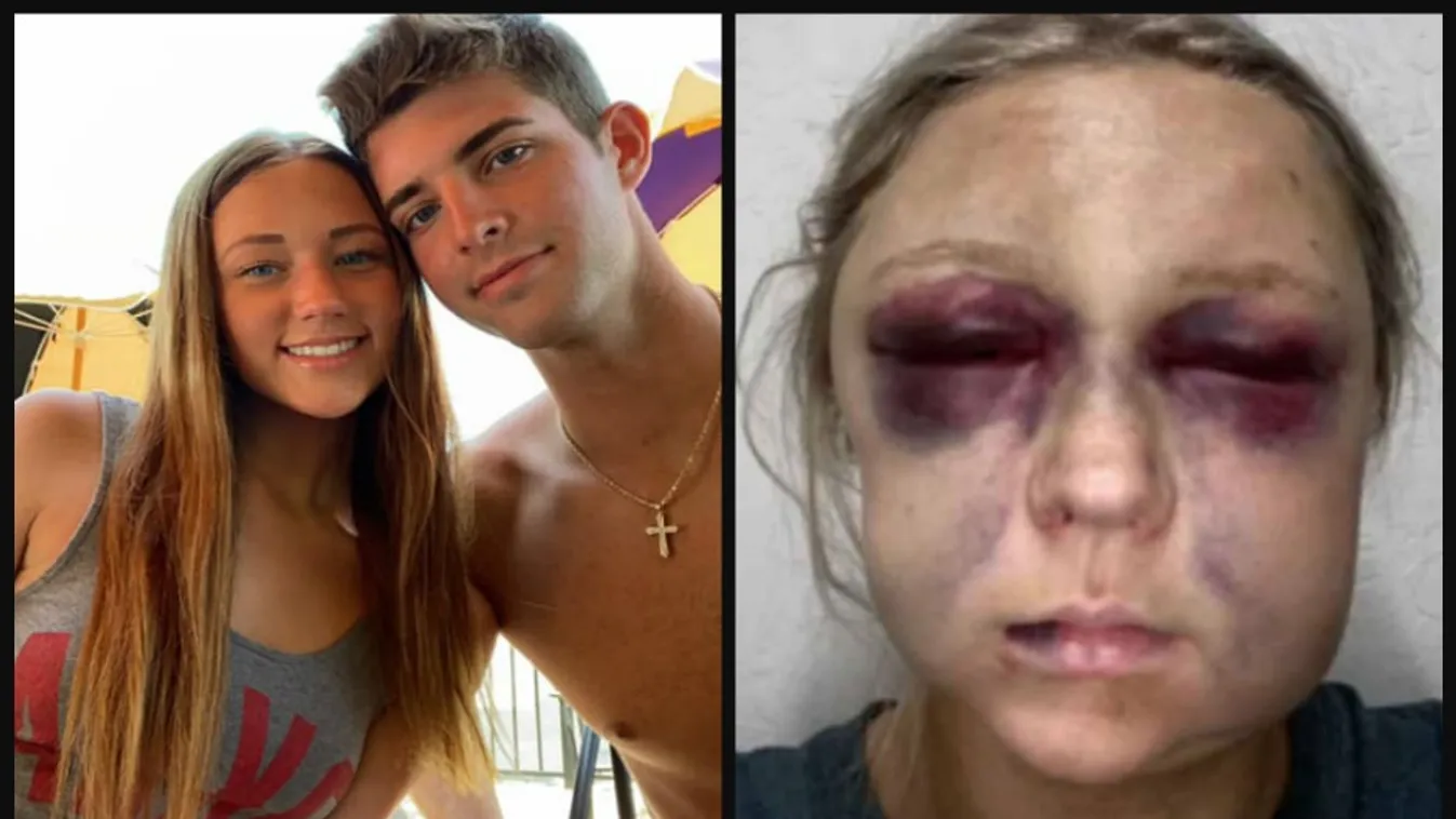 „Szabadulj meg tőle” - üvöltötte a férfi, miközben terhes barátnője hasát rugdosta