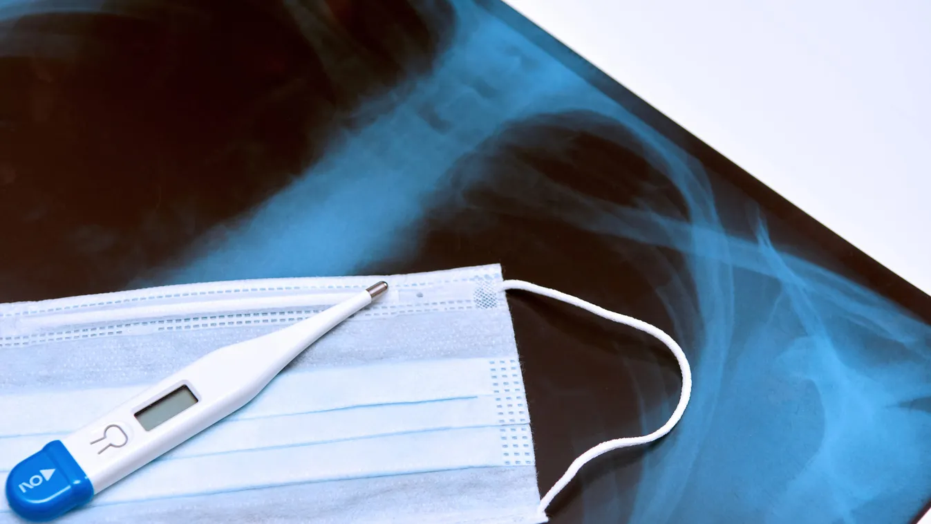 Hogyan ismerjük fel a koronavírust? Erre a 7 dologra kell figyelni