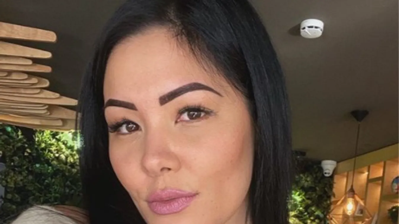 "Rettegtem, mit fognak szólni" - Ez történt a magyar tévésztár arcával - Fotó