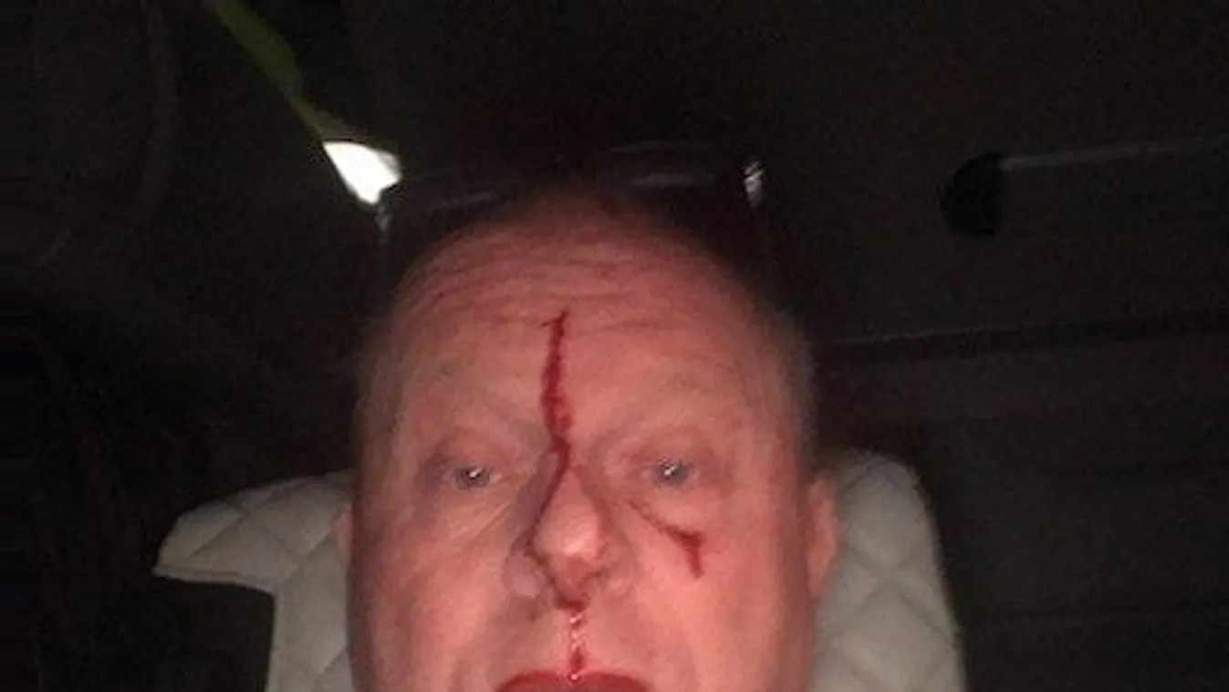 Egy maroknyi migráns csaknem agyonvert egy kamionost a franciaországi Calais-ban