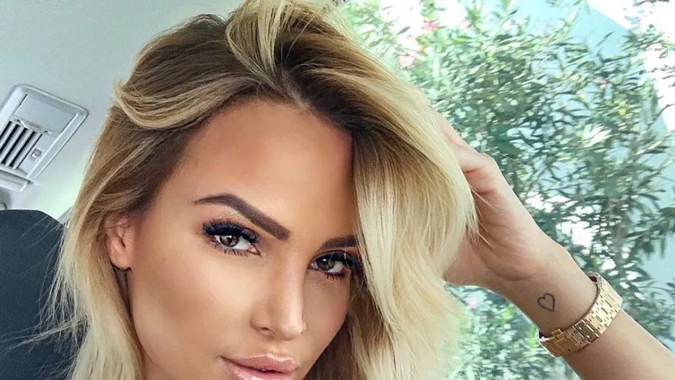 A plasztikai műtét után először mutatta meg magát Zimány Linda