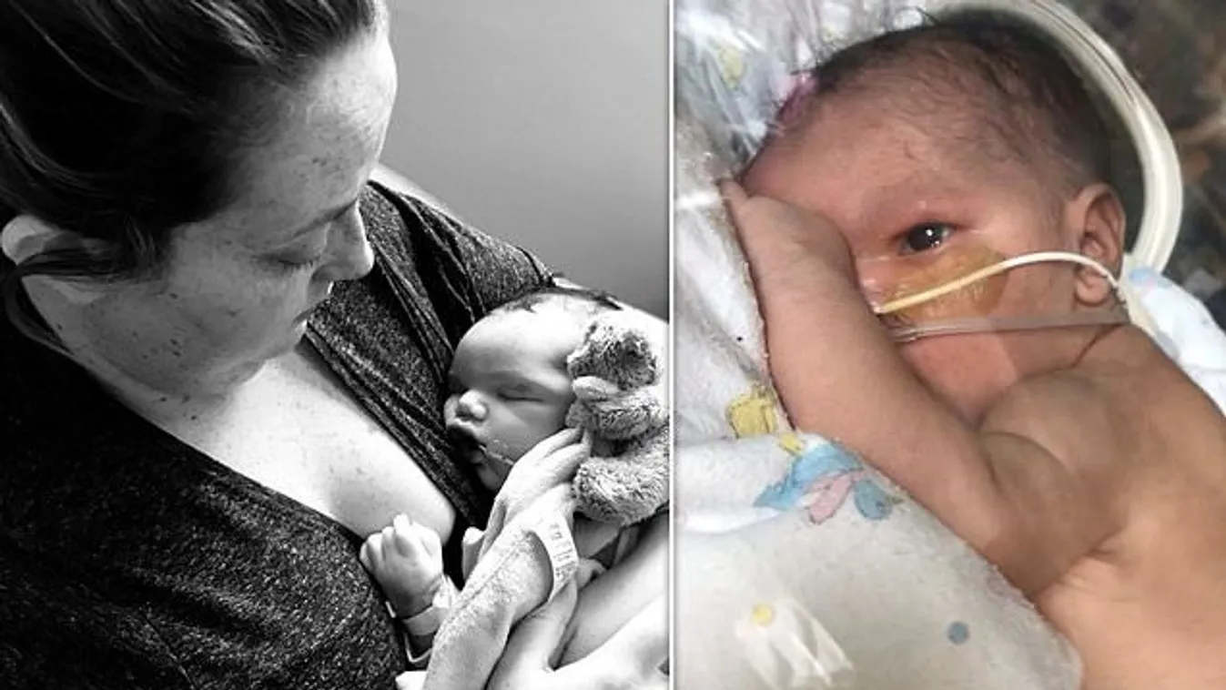 Váratlan tragédia: az orvosok hibájából kellett elveszítenie újszülött gyermekét egy édesanyának