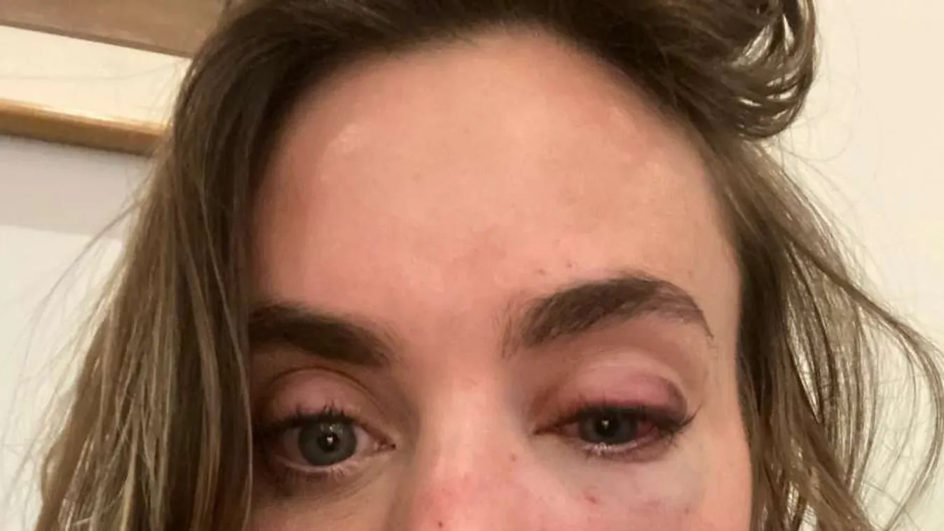 „Csak vissza akarom kapni" - véresre verték a nő arcát, majd ellopták a kutyáját - sokkoló fotó