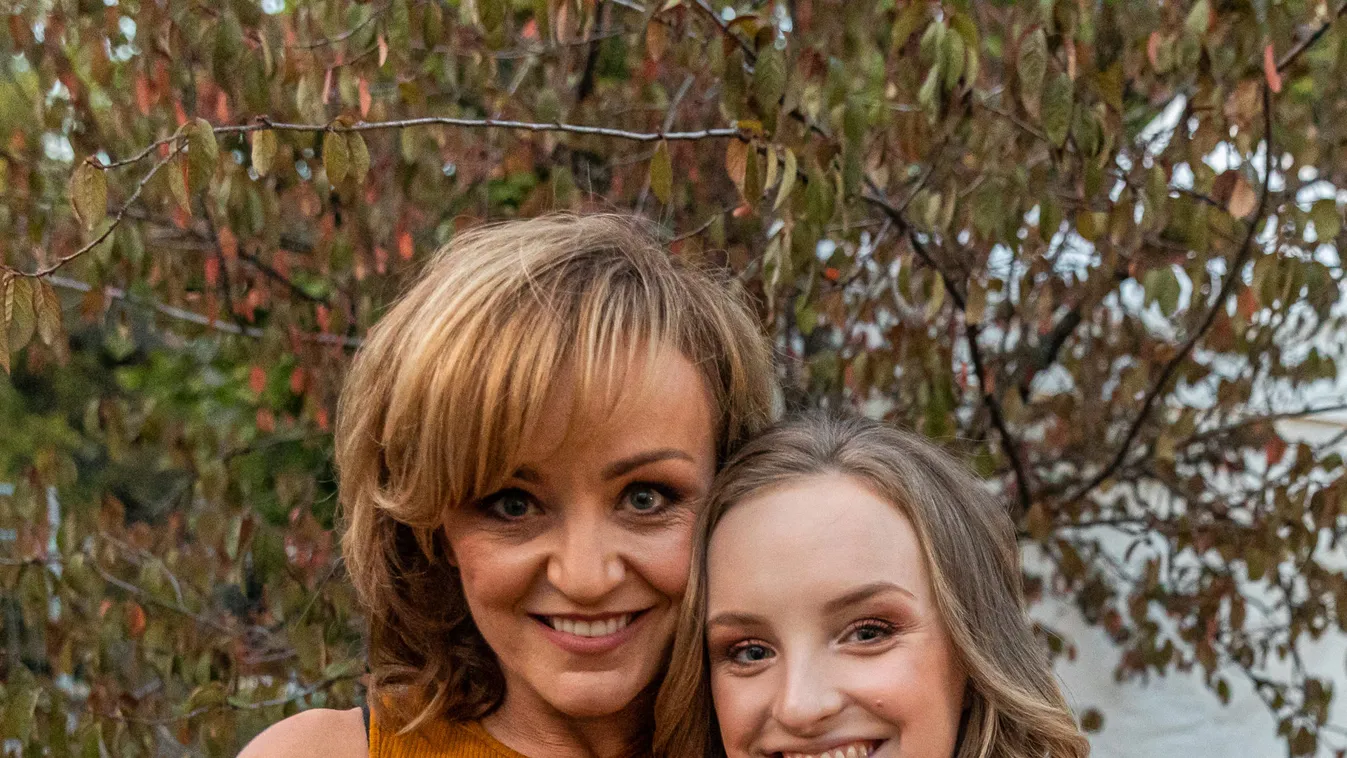 Ez fájhatott: Csúnyán megégette magát Szandi - Fotó