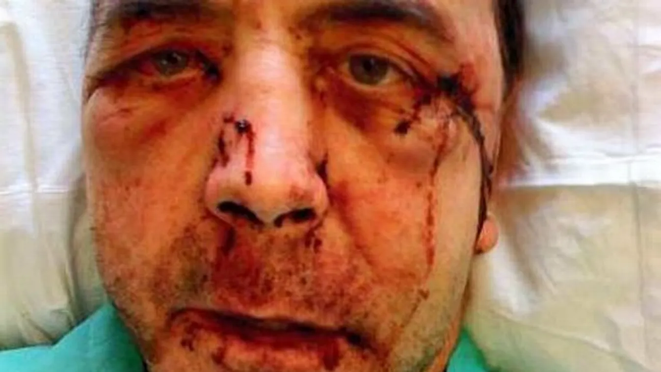 „Majdnem meghaltam azon az éjszakán" – volt diák esett neki a dirinek