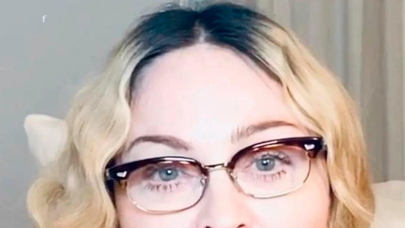 Madonna eltorzult arccal üzent a rajongóinak - Videó