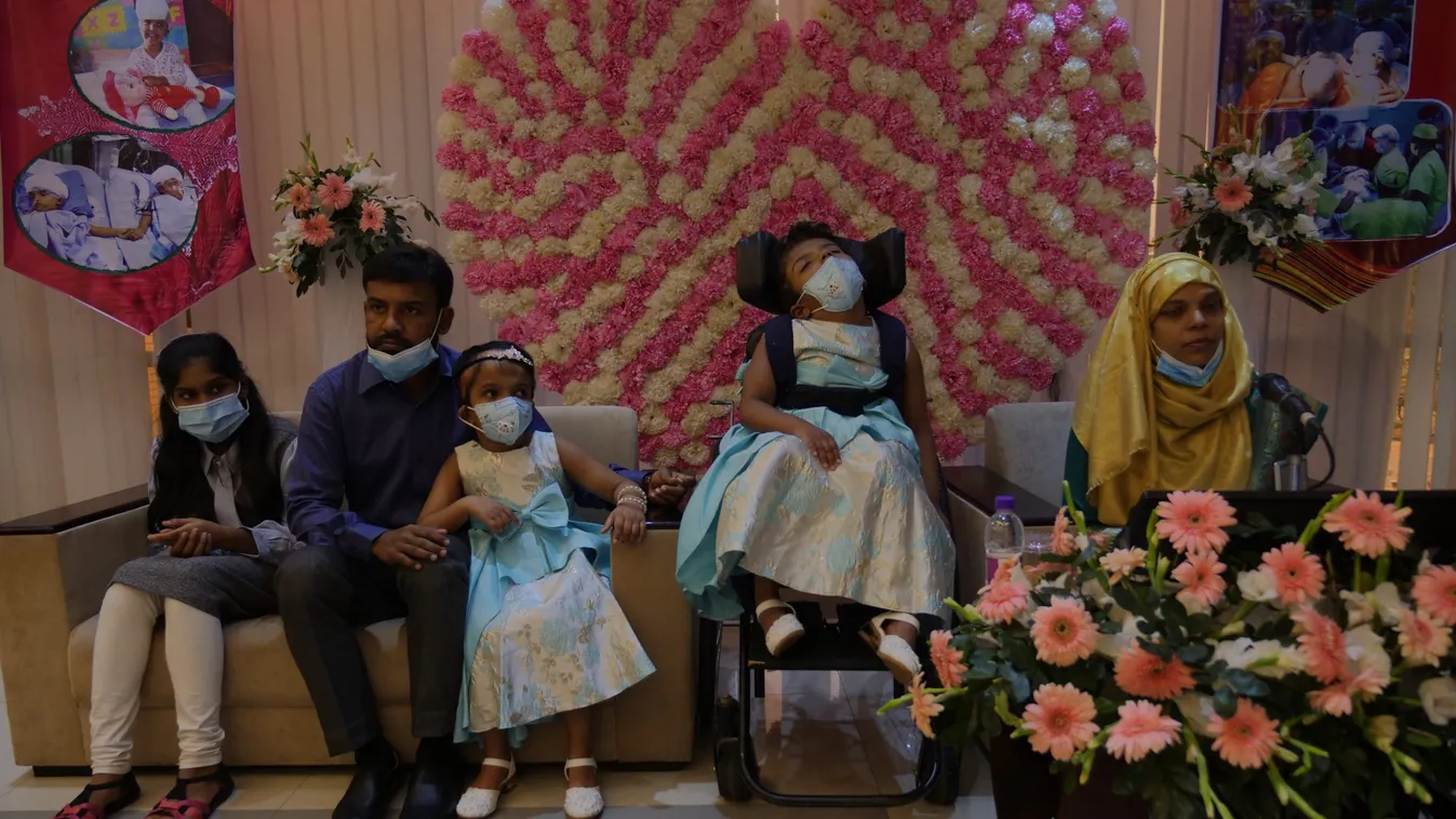 Két év után ma hazatérhettek a szétválasztott bangladesi sziámi ikrek