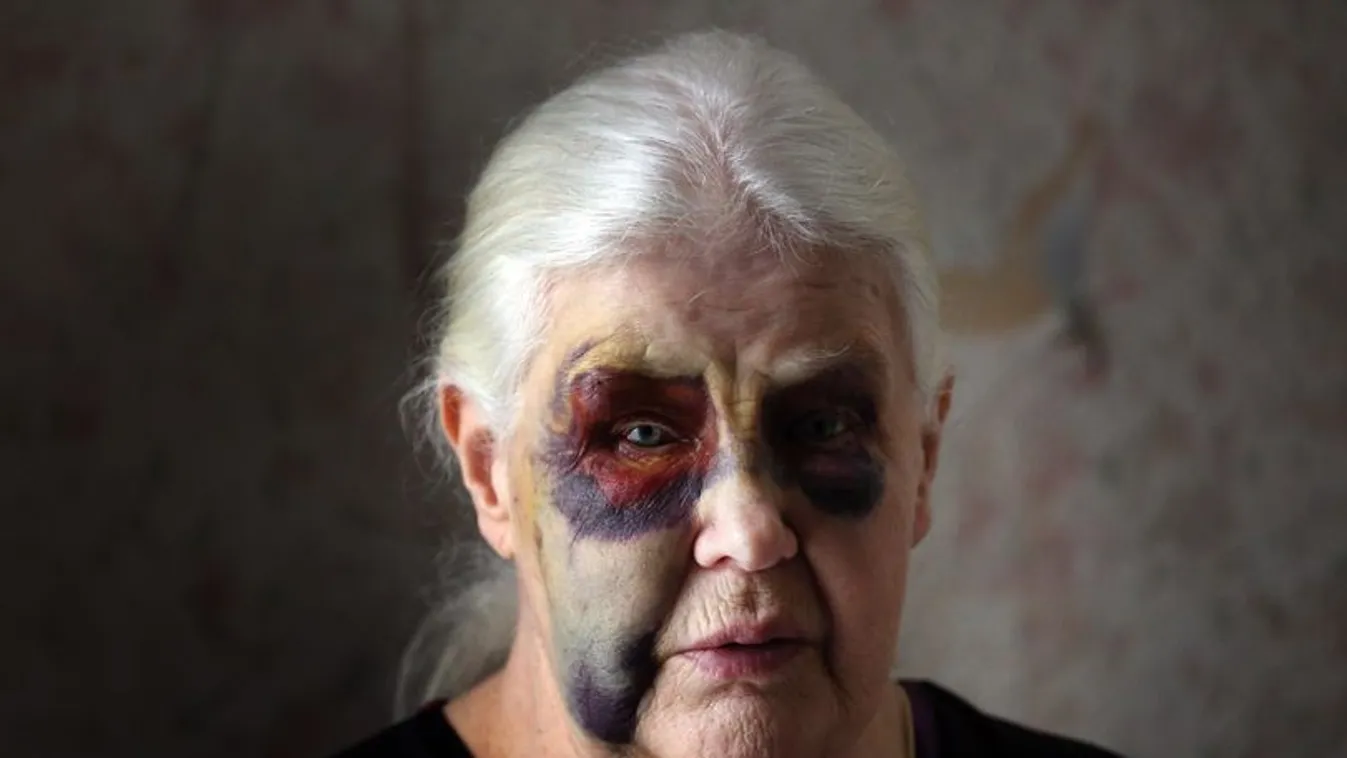 „Egyből rám rontottak" - borzalmas támadás érte a 79 éves nénit - megrázó fotók