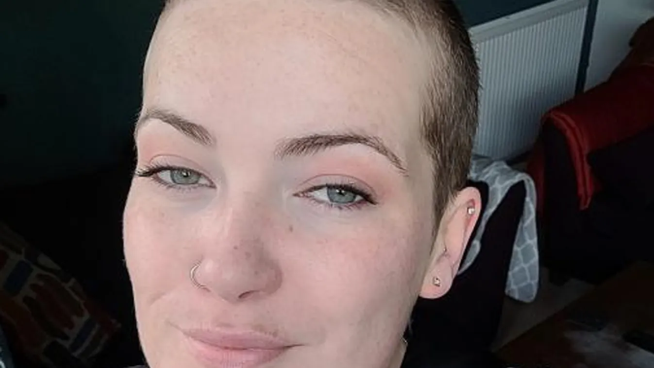 Csak a foga fájt a fiatal nőnek, néhány hét múlva súlyos betegséget diagnosztizáltak nála