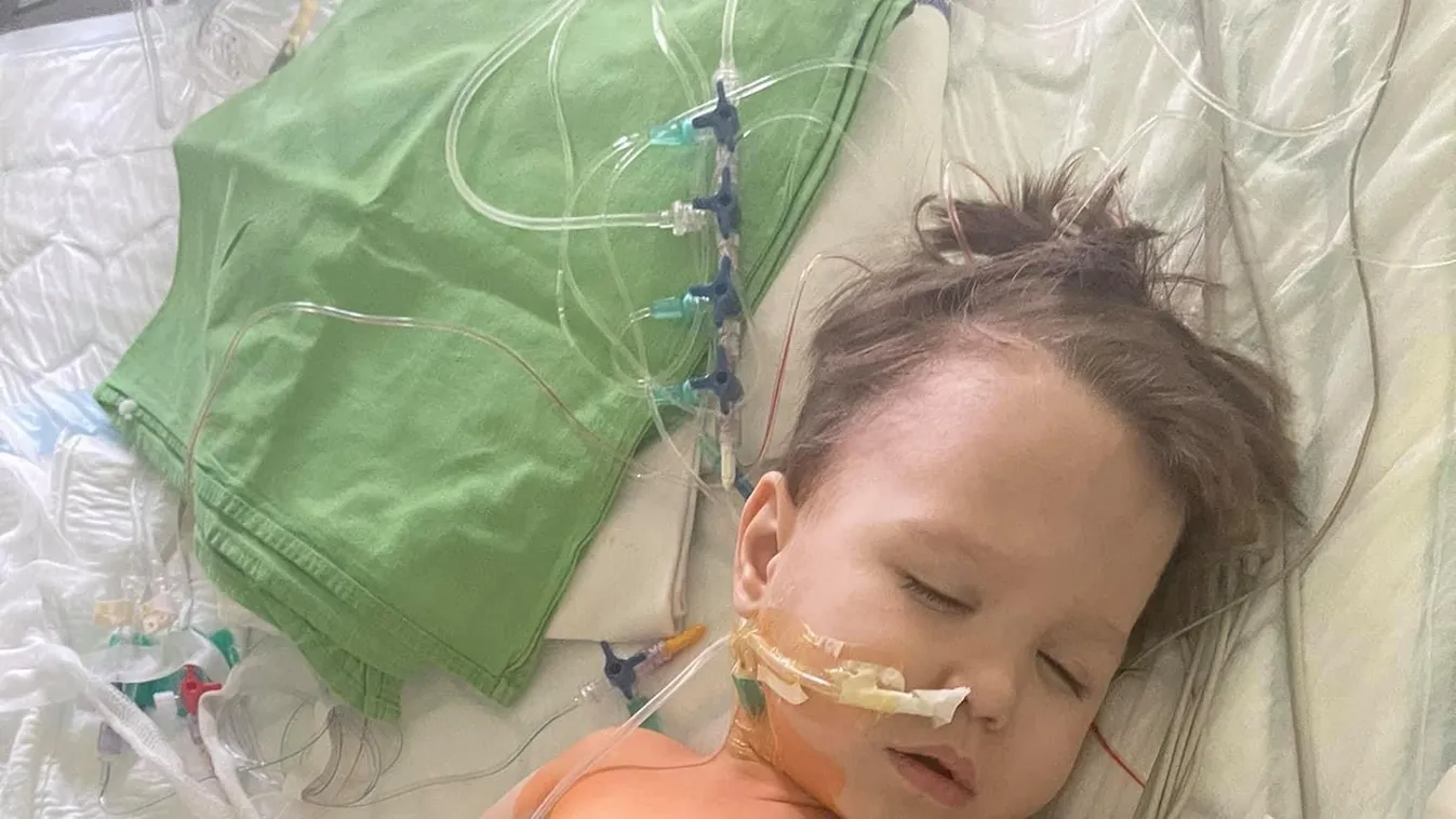 Összeszorul a szív: így küzd a túlélésért az új vesét kapott magyar kisfiú