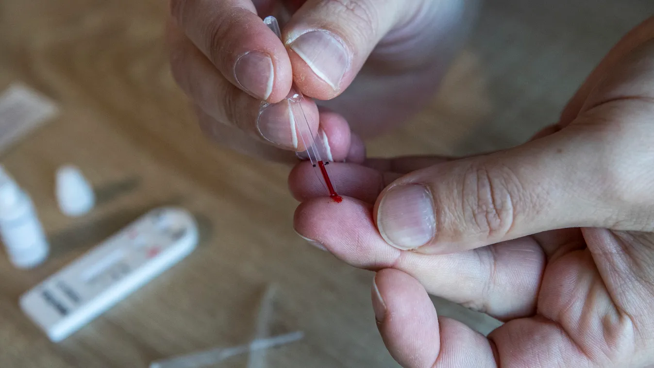 Dr. Rusvai Miklós: Ezért nem mindegy, milyen koronavírustesztet veszel!