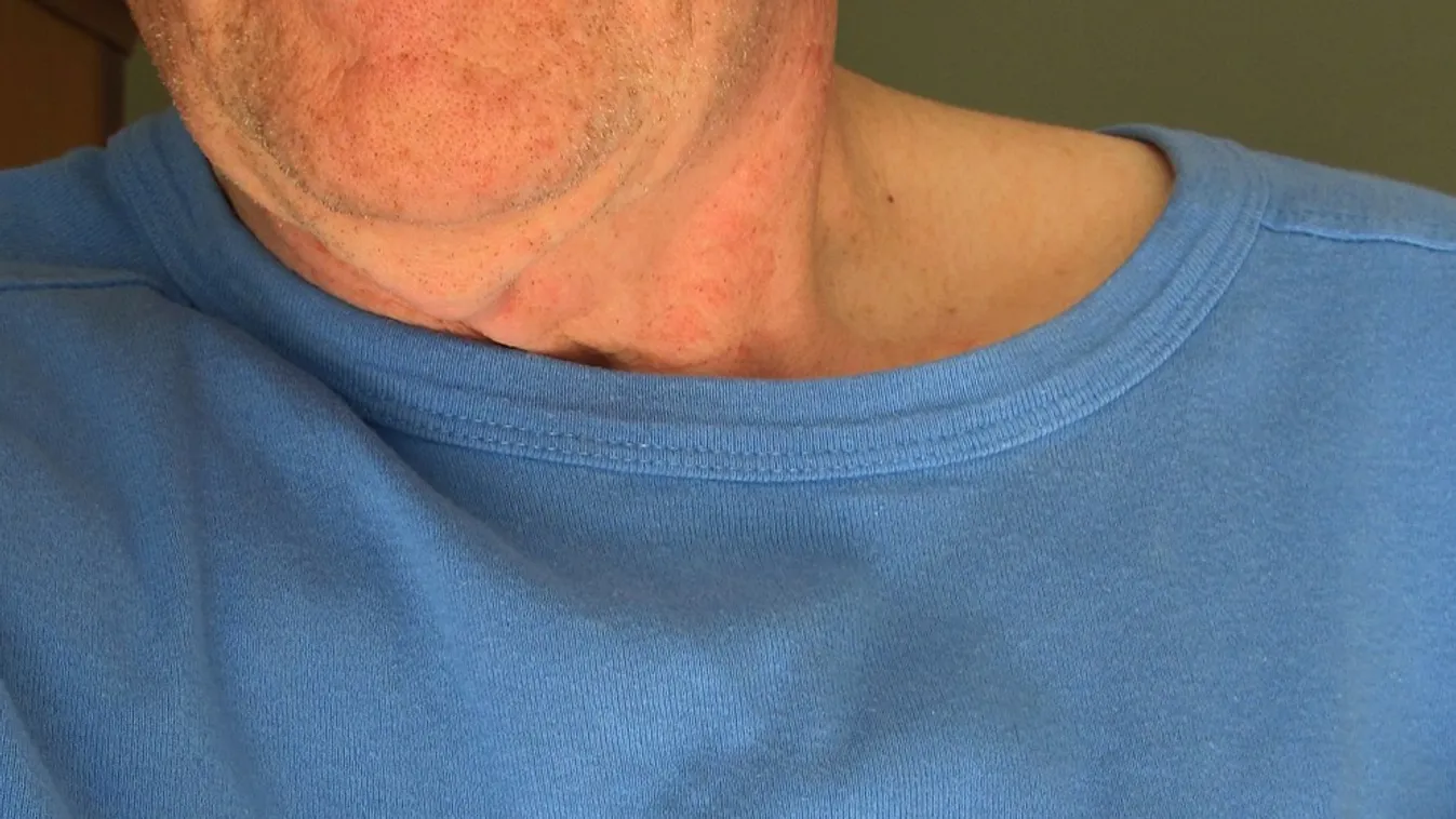 Döbbenetes, mit találtak a Covid miatt meghalt áldozatok szívében