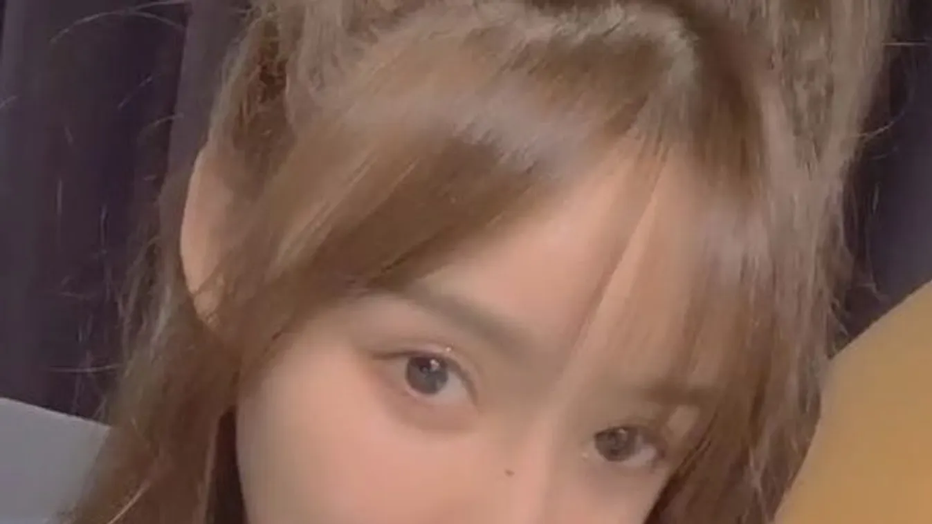 Rémálom a műtőasztalon: szörnyű, mi történt a gyönyörű színésznő orrával - Fotó