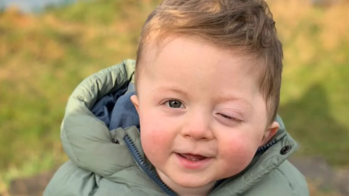 Bedagadt a szeme, majd borzasztó tünetek jelentkeztek a kisfiúnál - súlyos betegséget diagnosztizáltak nála